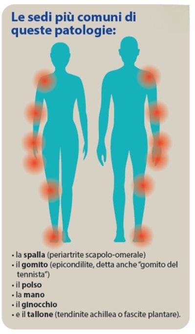 Tendiniti e Periartriti