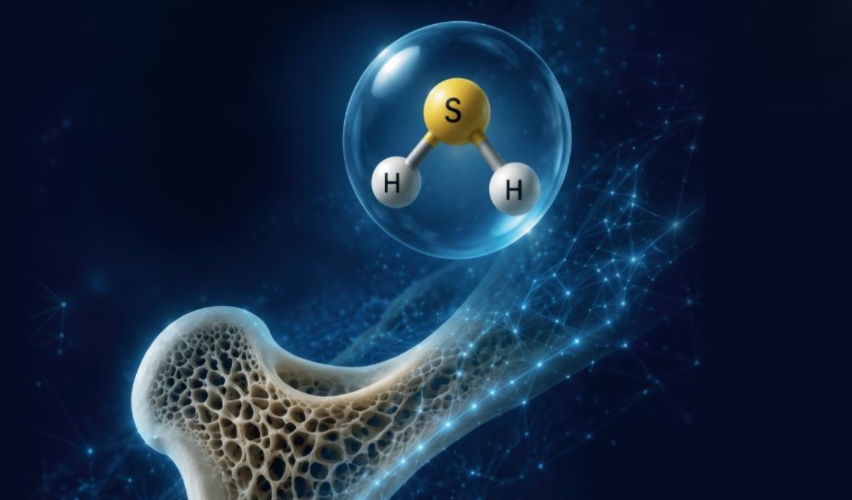 idrogeno solforato